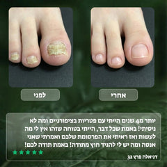 Koncherto Nail Fungus Serum koncherto