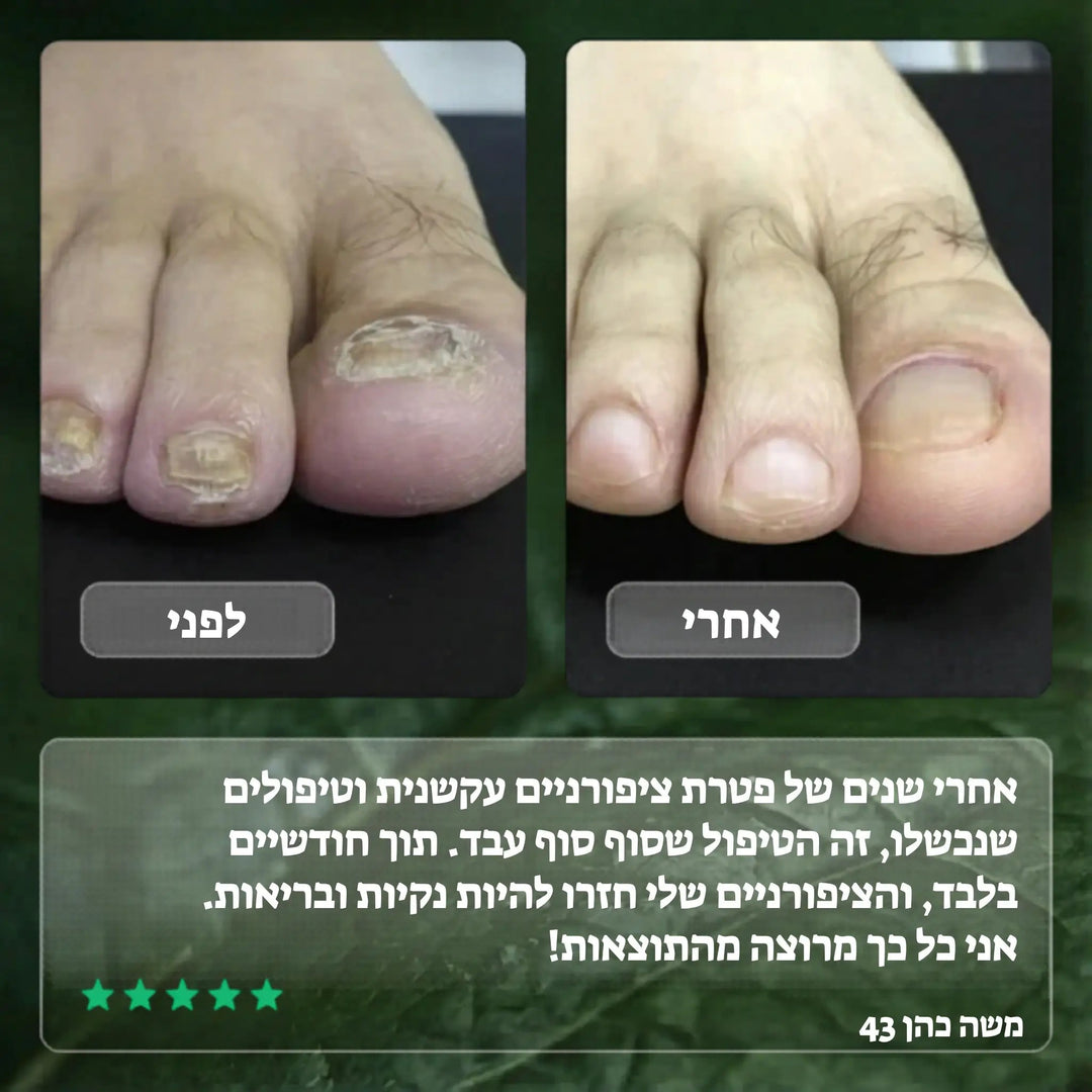 Koncherto Nail Fungus Serum koncherto