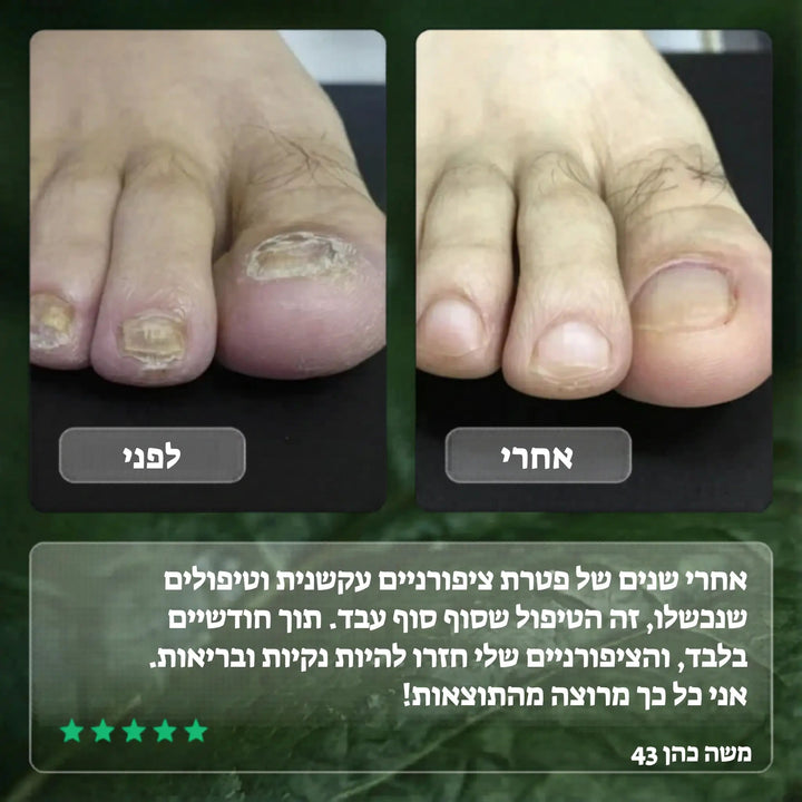 Koncherto Nail Fungus Serum koncherto