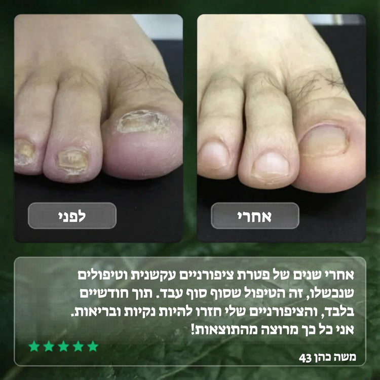 Koncherto Nail Fungus Serum koncherto
