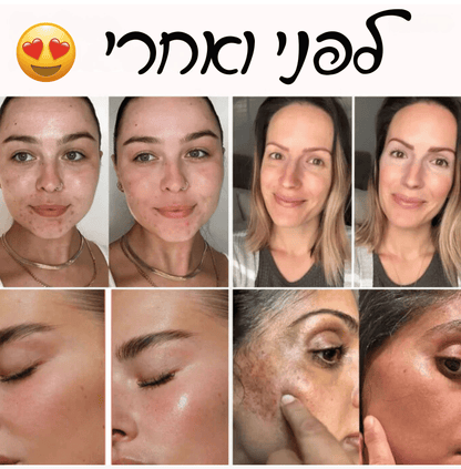 קונצרטו מסכה קוריאנית™