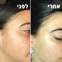 Koncherto Face Trimmer koncherto