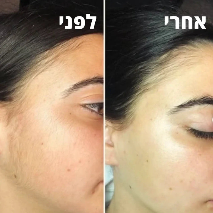 Koncherto Face Trimmer koncherto